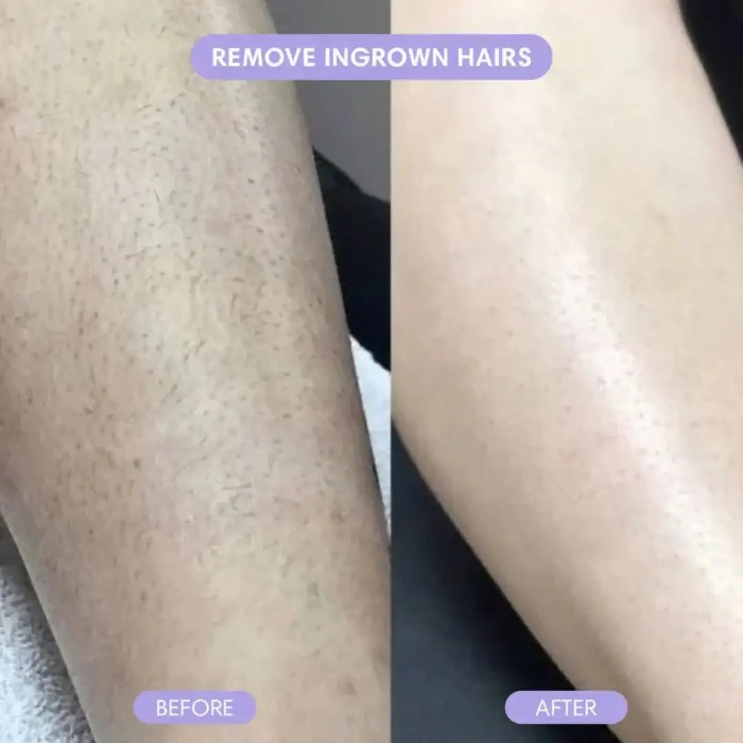 Crystal Hair Eraser – Painless Hair Removal & Exfoliation Tool for Smooth Skin